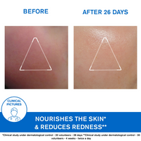 Thumbnail for Uriage Xemose Face Cream - Distacart