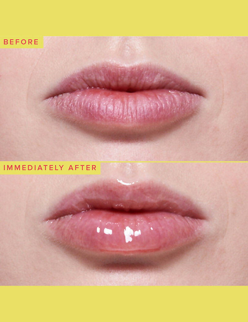 384bb4a818832022431_4