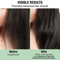 Thumbnail for Nykaa Naturals Advanced Hair Growth Shampoo With Rosemary & Naturally Derived Niacinamide