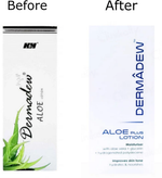 Thumbnail for Dermadew Aloe Plus Moisturiser Lotion - Distacart