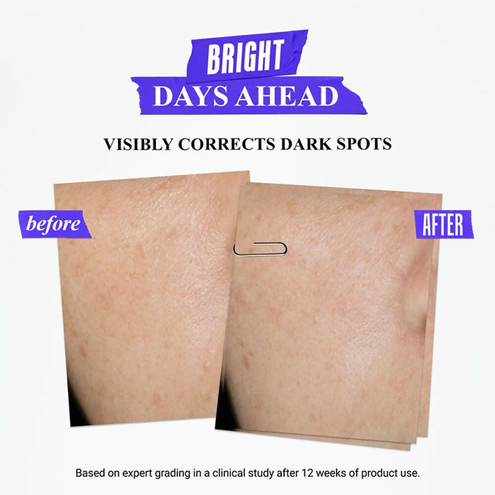 Kiehl's Daily Skincare Routine CSMS (Cleanser, Serum, Moisturizer, Sunscreen) Combo - Distacart