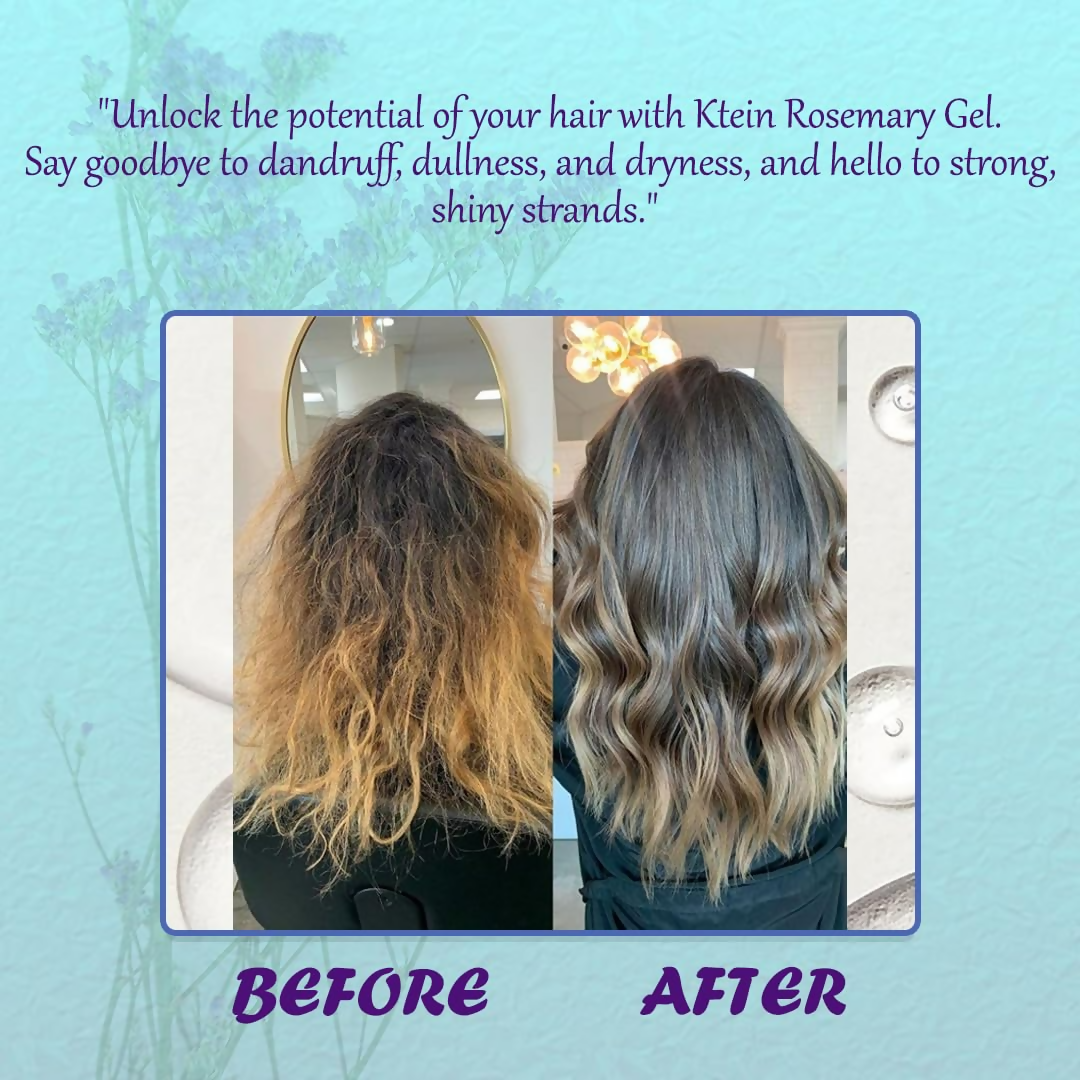 Ktein Rosemary Gel: 95% Rosemary Infused Hair Care Gel - Distacart