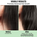 Thumbnail for Nykaa Naturals Rosemary & Naturally Derived Niacinamide Shampoo + Mask Hair Growth - Distacart