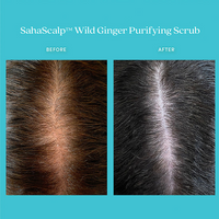 Thumbnail for Fable & Mane Sahascalp Purifying Scrub To Gently Exfoliate Scalp With Wild Ginger&Pink Himalayan Salt