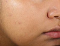 Thumbnail for Murad Clarifying Water Gel