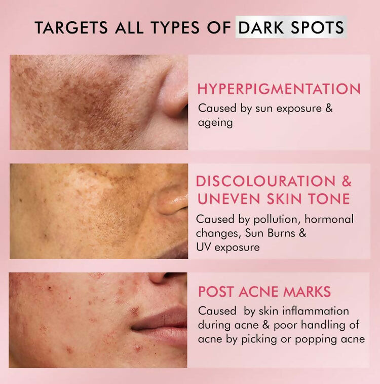 mCaffeine Clear Glow 2% Kojic Acid,1% Niacinamide De-Pigmentation Cream - Distacart