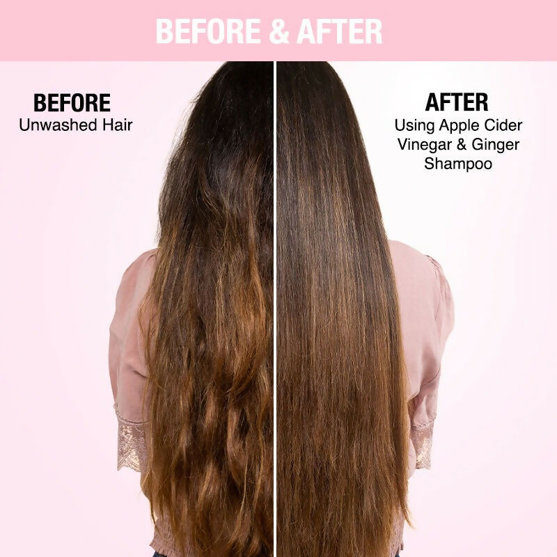 Nykaa Naturals Anti-Dandruff - Free Shampoo with Apple Cider Vinegar, Ginger & Tea Tree Oil - Distacart