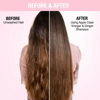Thumbnail for Nykaa Naturals Anti-Dandruff - Free Shampoo with Apple Cider Vinegar, Ginger & Tea Tree Oil - Distacart