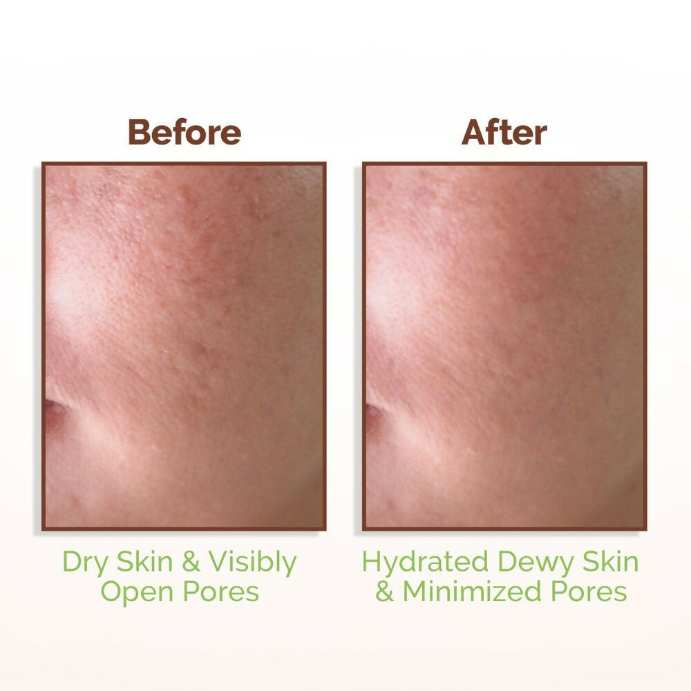 Mamaearth Rice Water Dewy Face Toner with 96% Pure Rice Water Extract & 4% Niacinamide for Glass Skin - Distacart