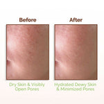 Thumbnail for Mamaearth Rice Water Dewy Face Toner with 96% Pure Rice Water Extract & 4% Niacinamide for Glass Skin - Distacart