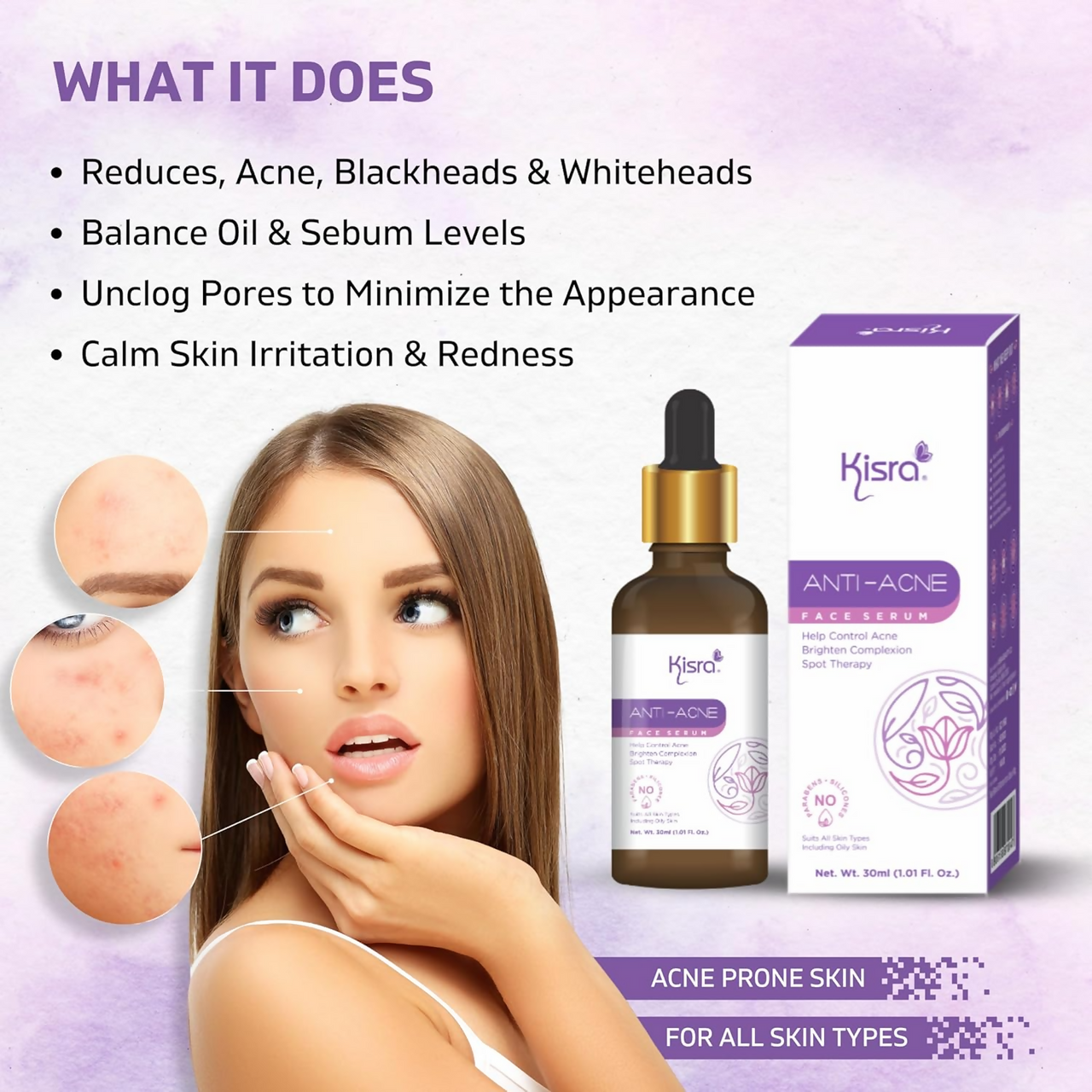 Kisra Anti-Acne Face Serum for Acne
