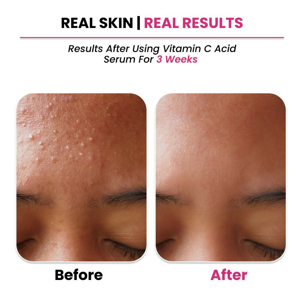 Thriveco 10% Vitamin C+ Hyaluronic Acid Serum - Distacart