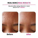 Thumbnail for Thriveco 10% Vitamin C+ Hyaluronic Acid Serum - Distacart