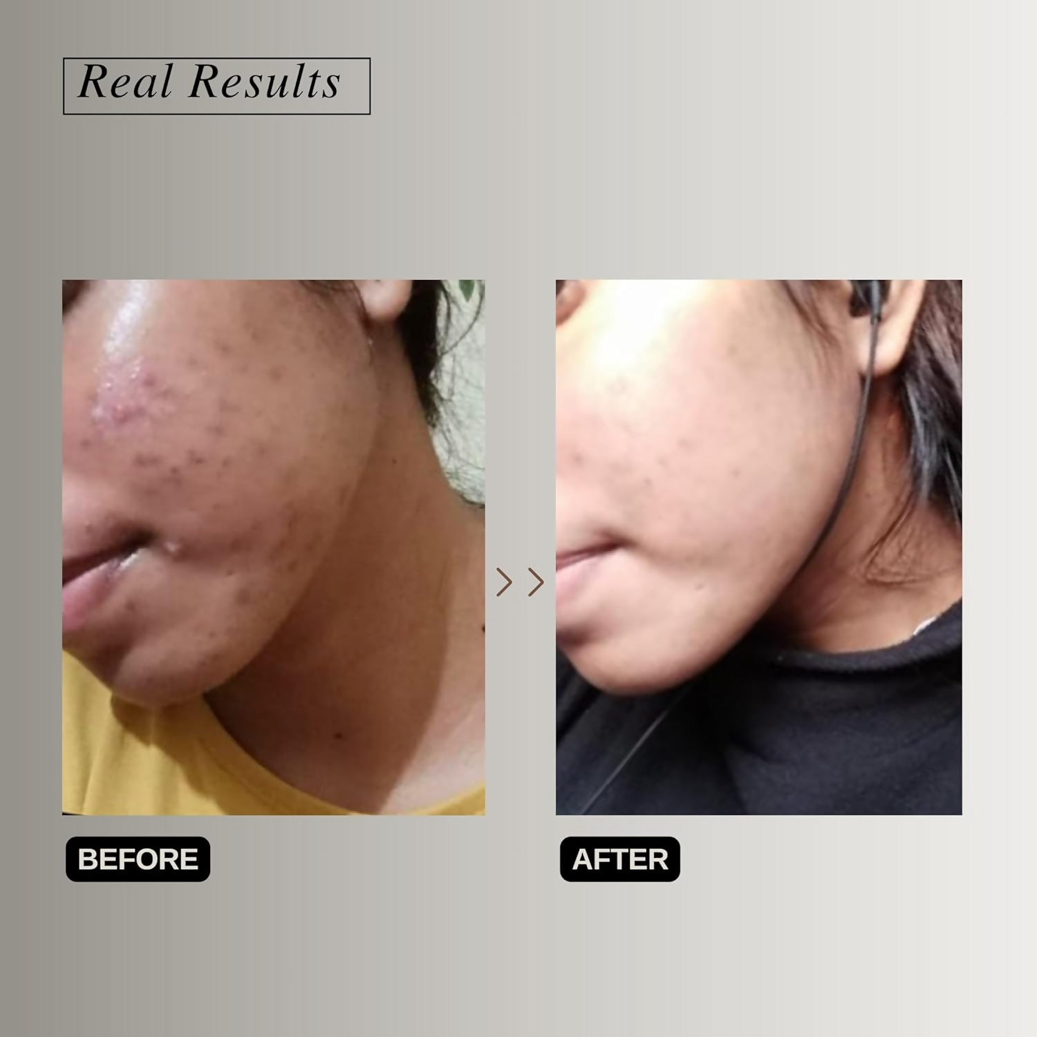 The Formularx Vitamin C Brightening Serum With Arbutin & Nag For Glowing Skin - Distacart