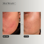 Thumbnail for The Formularx Peptide Ceramide Moisturizer - Barrier Plus - Distacart