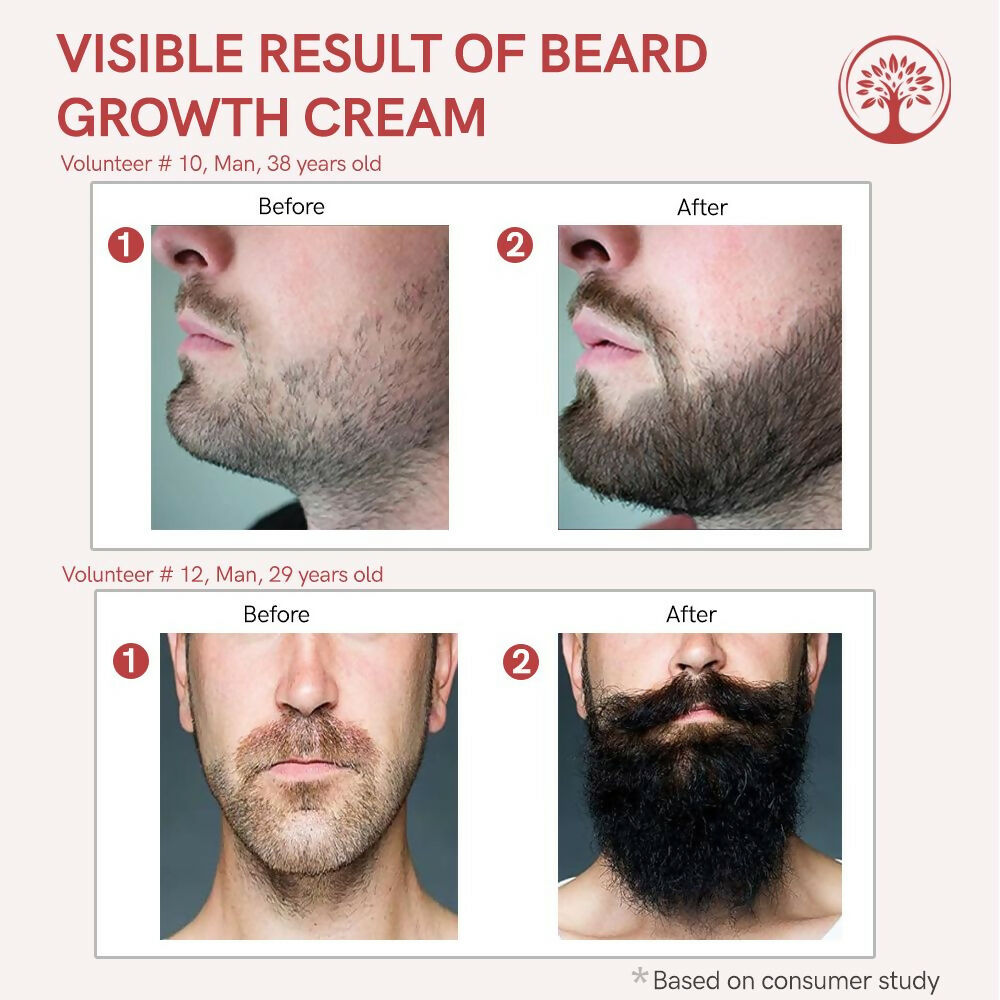 Ivory Natural Beard Growth Cream - Biotin Boosted Hair Follicle For New Hair Cycle - Distacart