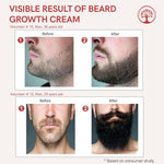 Thumbnail for Ivory Natural Beard Growth Cream - Biotin Boosted Hair Follicle For New Hair Cycle - Distacart