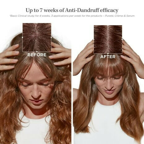Kerastase Symbiose Bain Pureté Anti-Dandruff Shampoo - Distacart