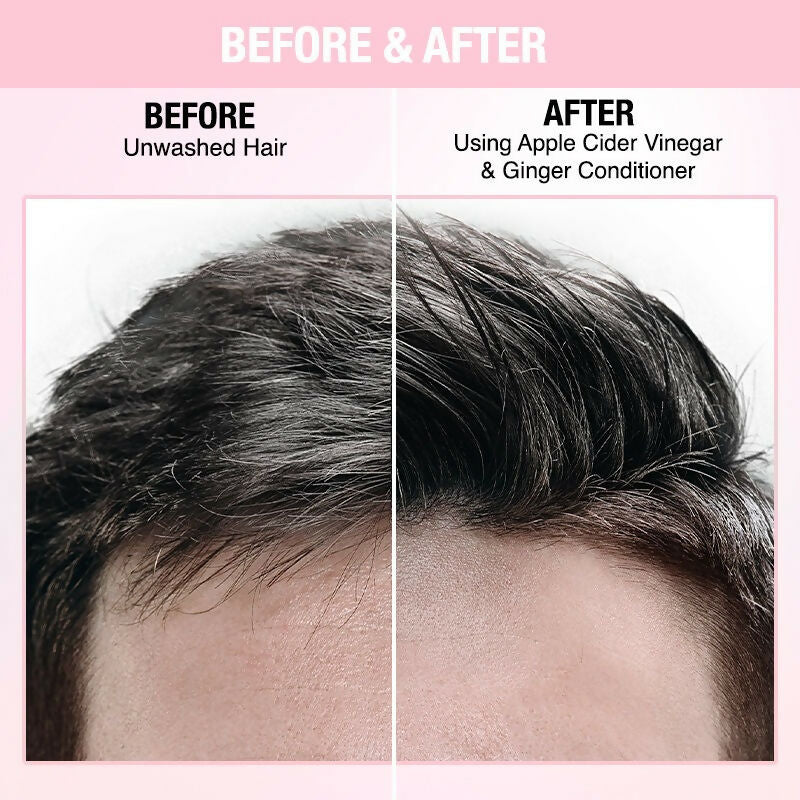 Nykaa Naturals Anti-Dandruff-Free Conditioner With Apple Cider Vinegar & Ginger - Distacart