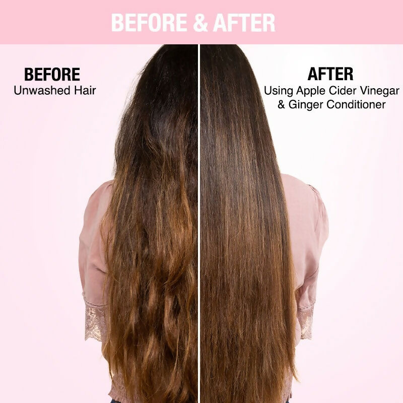 Nykaa Naturals Anti-Dandruff-Free Conditioner With Apple Cider Vinegar & Ginger - Distacart