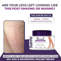 Thumbnail for Sanfe Reveal No More Bumps Erasing Body Scrub - Distacart