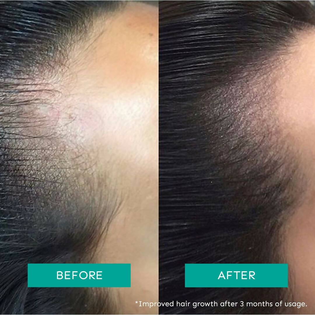 Arata Intensive Hair Growth Serum - Distacart