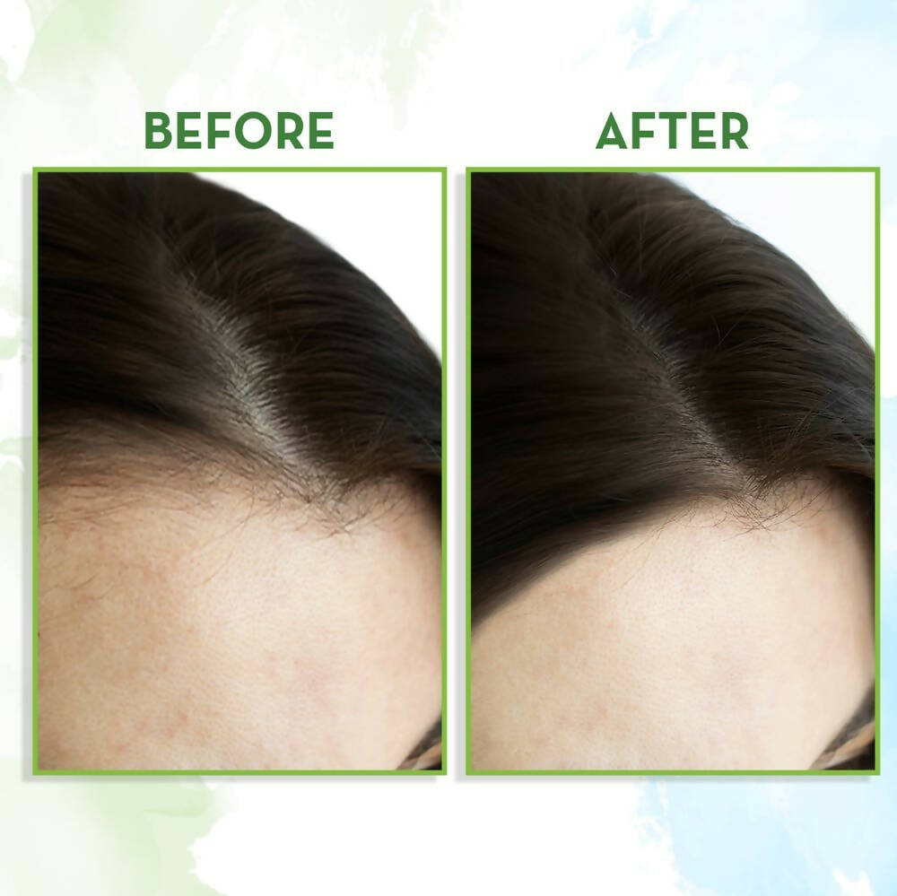 Mamaearth Rosemary Hair Growth Oil with Rosemary & Methi Dana - Distacart