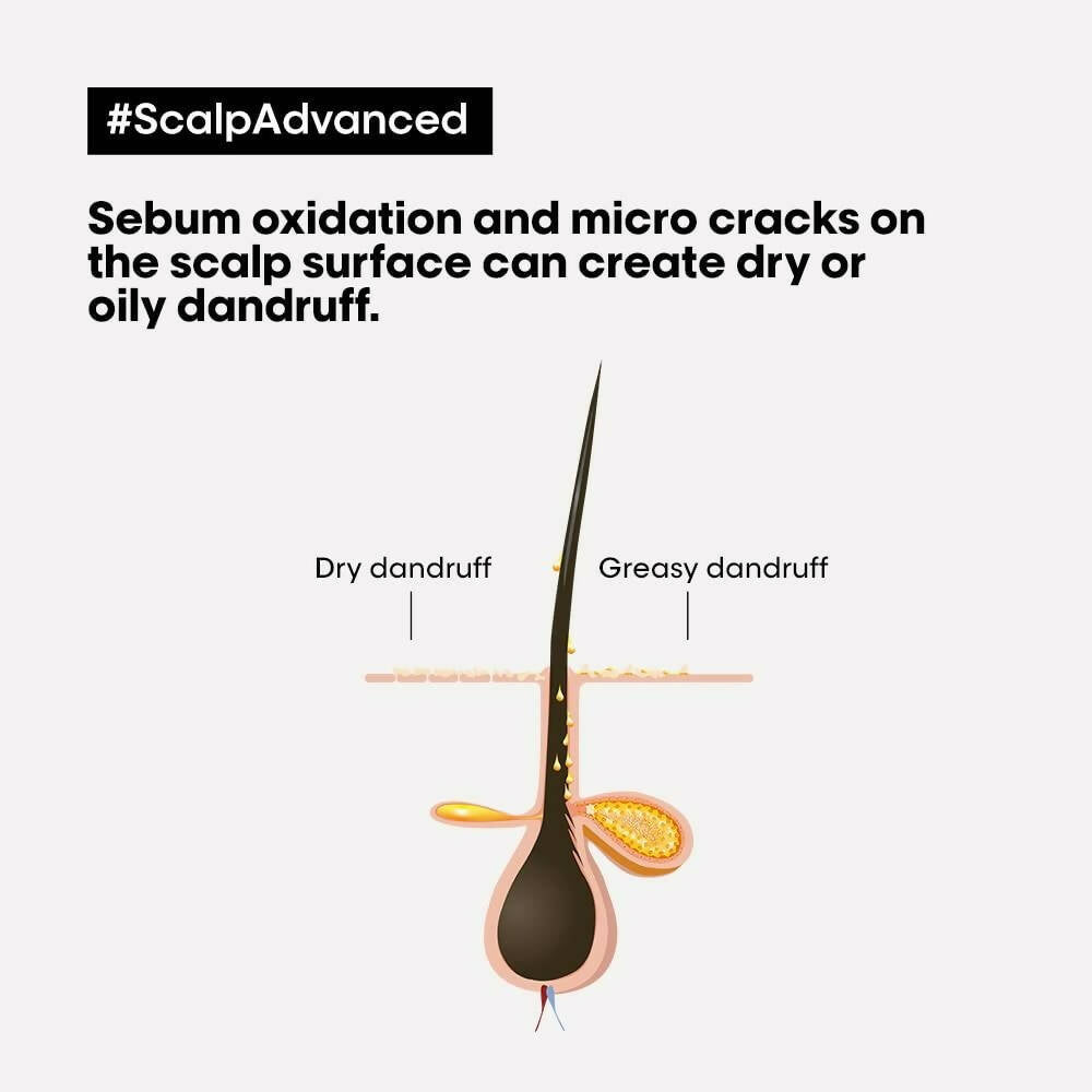 L'Oréal Paris Scalp Advanced Anti-Dandruff Dermo-Clarifier Shampoo & Liss Unlimited Hair Mask - Distacart