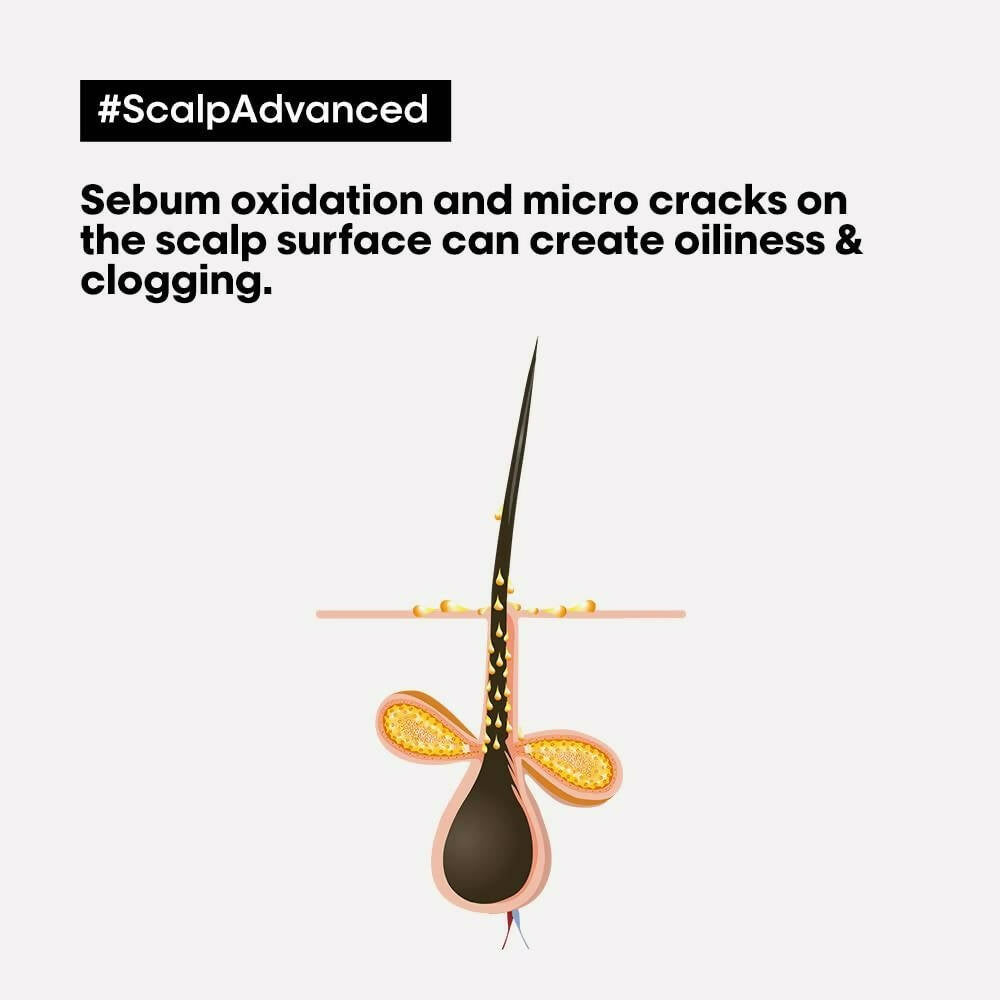 L'Oreal Paris Professionnel Scalp Advanced Anti-Oiliness 2-In-1 Deep Purifier Clay With 3% AHA - Distacart