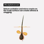 Thumbnail for L'Oreal Paris Professionnel Scalp Advanced Anti-Oiliness 2-In-1 Deep Purifier Clay With 3% AHA - Distacart