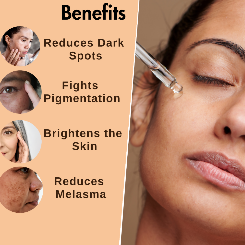 Dermistry Skin Perfecting Fairness Face Serum Resorcinol Kojic Acid Hyper Pigmentation Uneven Tone - Distacart