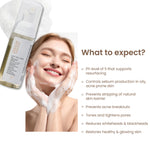 Thumbnail for Personal Touch Skincare Zitsit Gentle Foaming Anti Acne Facewash pH 5 For Dry, Oily, Normal & Acne Prone - Distacart