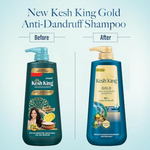 Thumbnail for Kesh King Gold Anti-Dandruff Shampoo - Dista