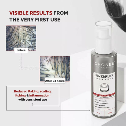 Chosen Pinedruff Scalp Serum Best Dandruff Control Treatment Solution With Pycnogenol - Distacart