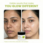 Thumbnail for The Skin Story Moringa Face Pack For Deep Cleansing - Distacart