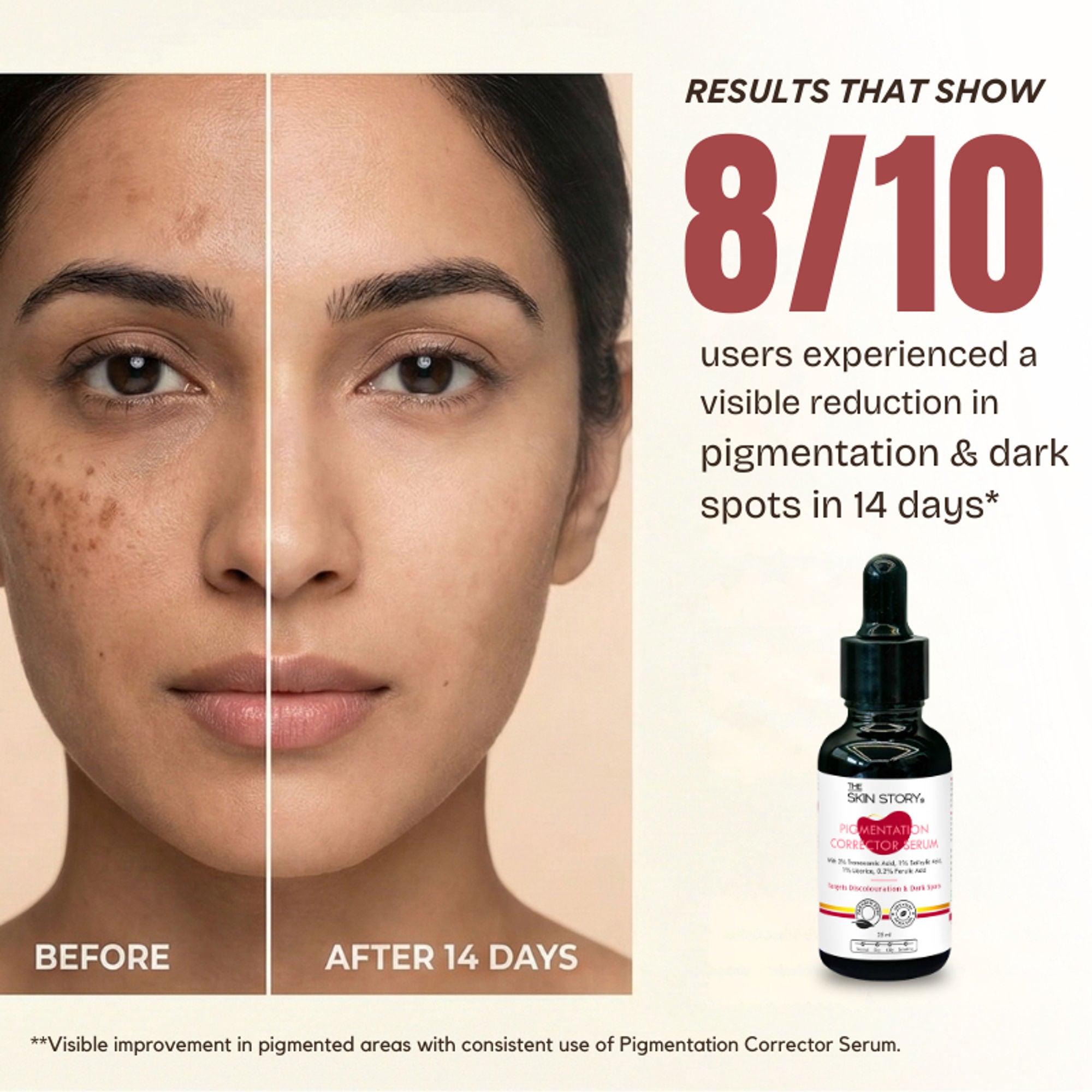 The Skin Story Anti Pigmentation Face Serum For Brighter Skin, Dark Spots, Niacinamide Alpha Arbutin - Distacart