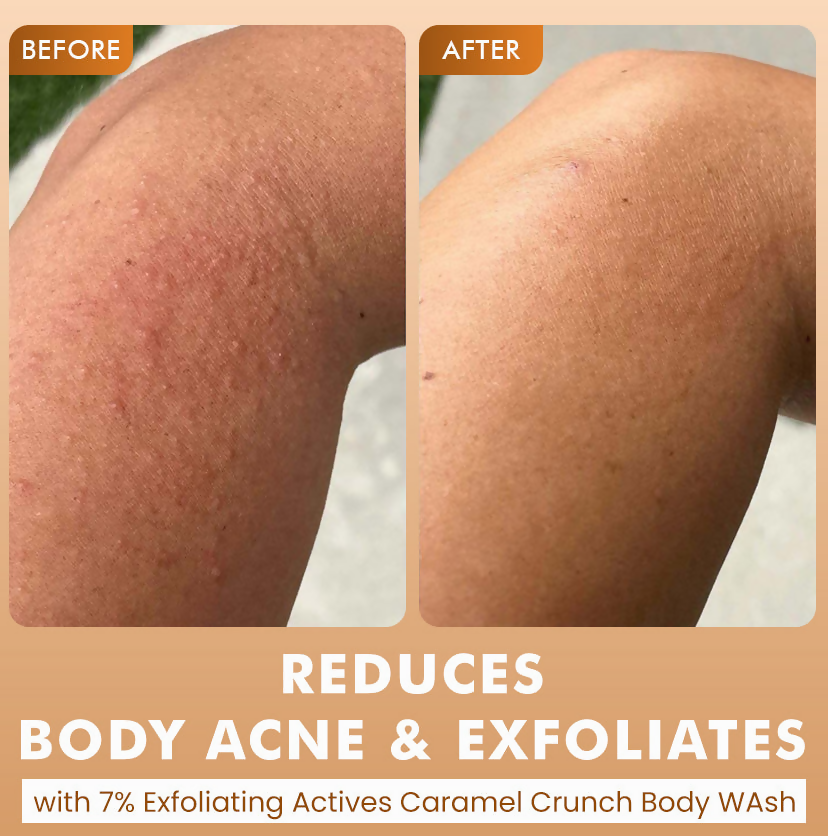 mCaffeine Brighten, De-Tan & Acne-Free Body Wash