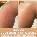 Thumbnail for mCaffeine Brighten, De-Tan & Acne-Free Body Wash