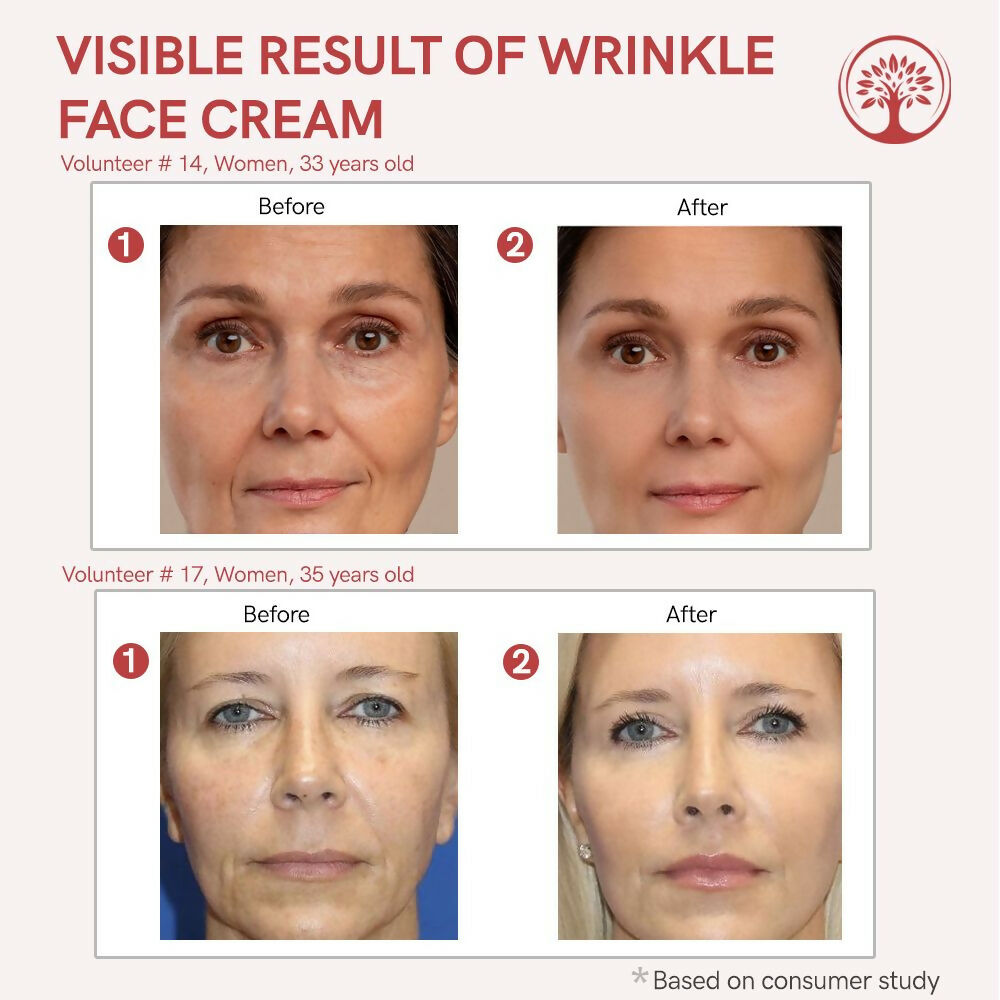 Ivory Natural Wrinkle Face Cream For More Radiant And Youthful Look - Distacart
