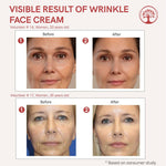 Thumbnail for Ivory Natural Wrinkle Face Cream For More Radiant And Youthful Look - Distacart