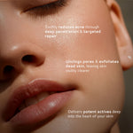 Thumbnail for Lumineve 2% Salicylic Acid Face Serum for Active Acne & Pores with Advanced NightRenew Complex - Distacart