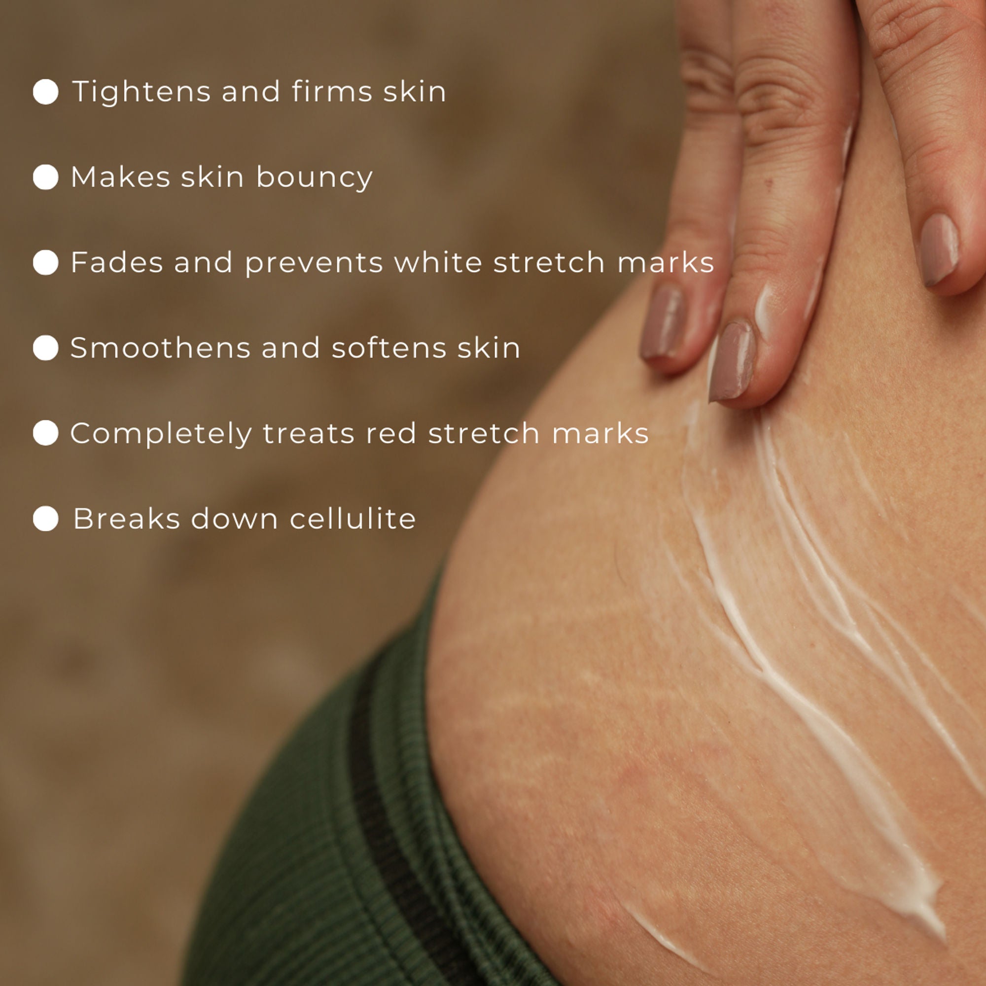 Skinvest Bomb bum cream for Stretch Marks + Cellulite - Distacart