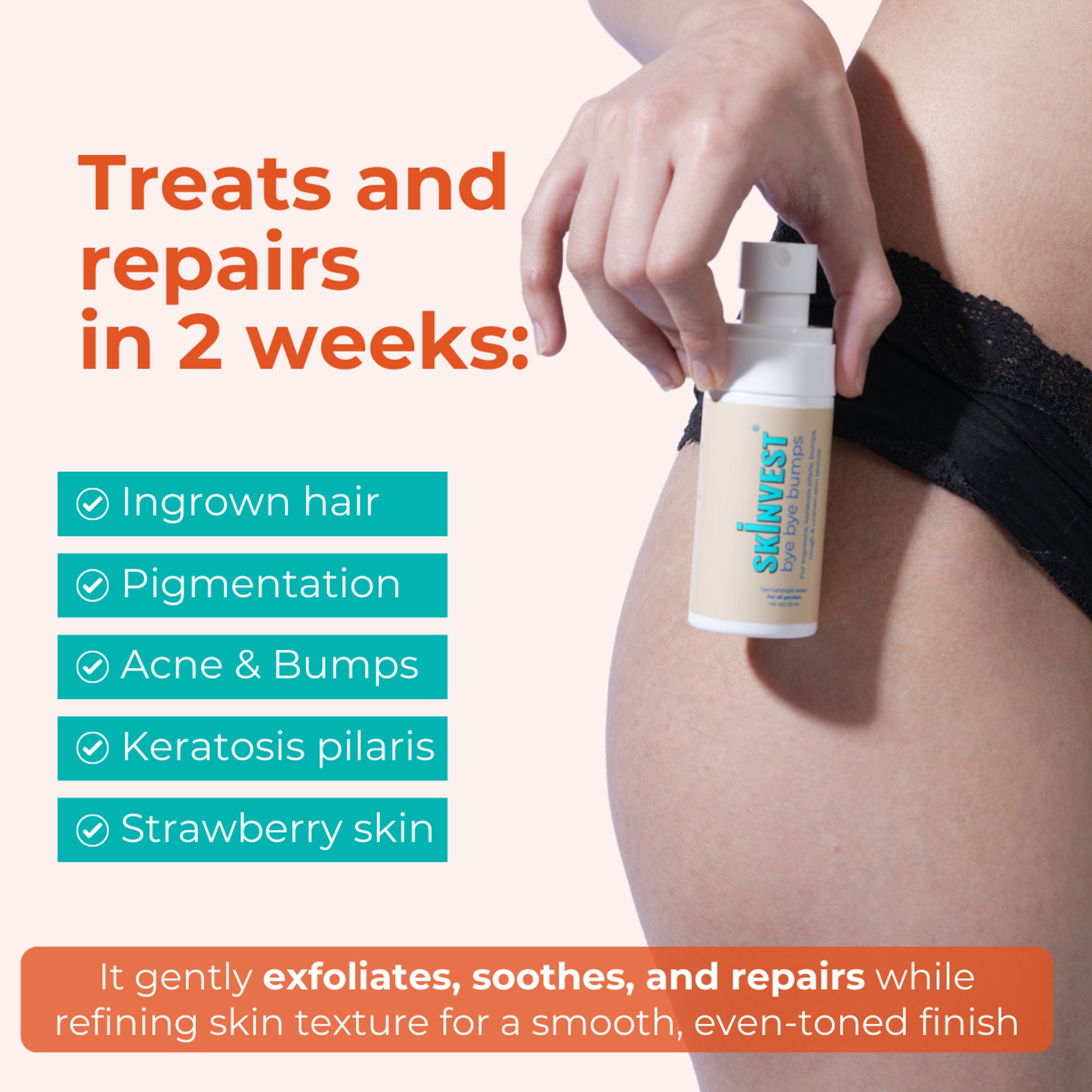 Skinvest Bye Bye Bumps - Exfoliating Body Mist - Distacart