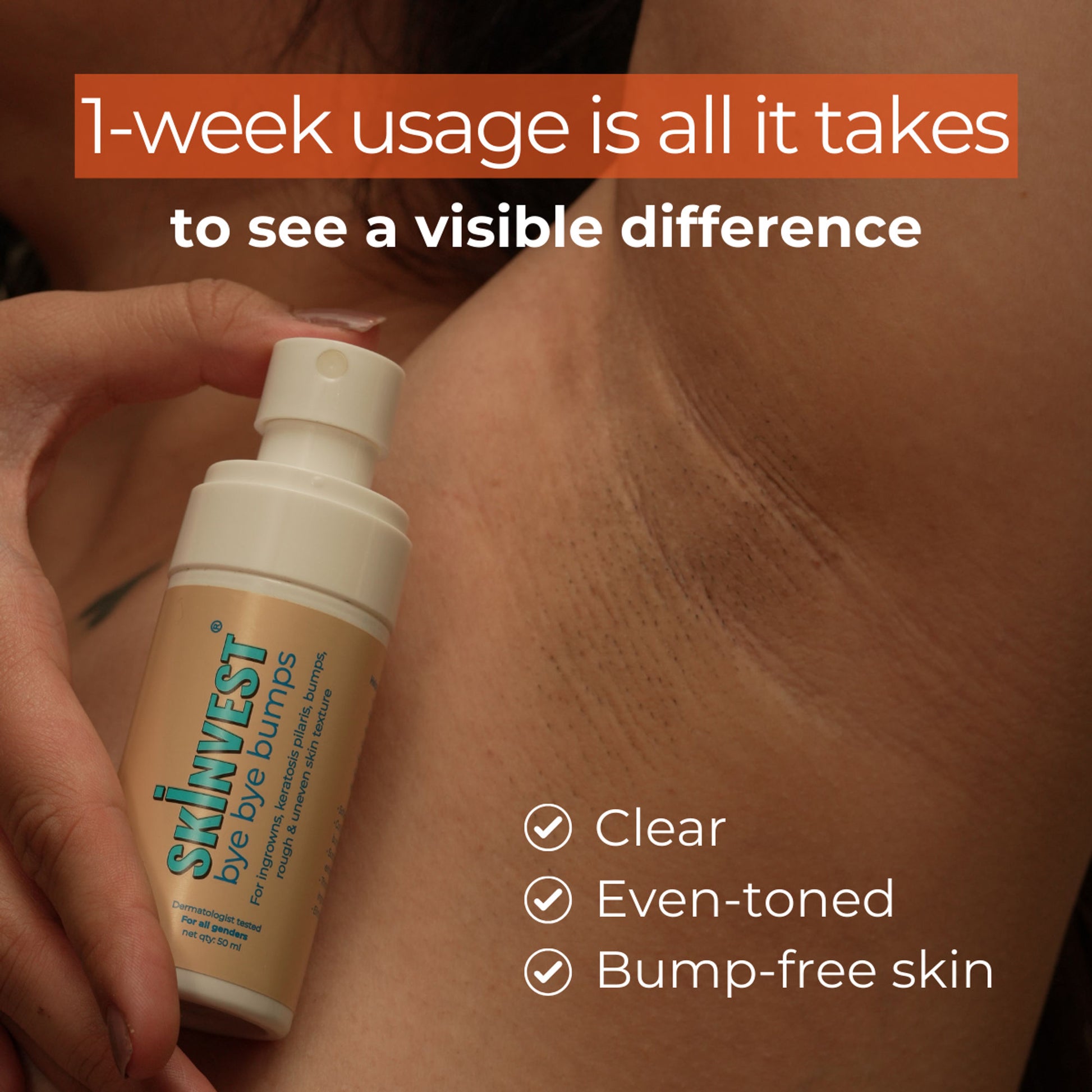Skinvest Bye Bye Bumps - Exfoliating Body Mist - Distacart