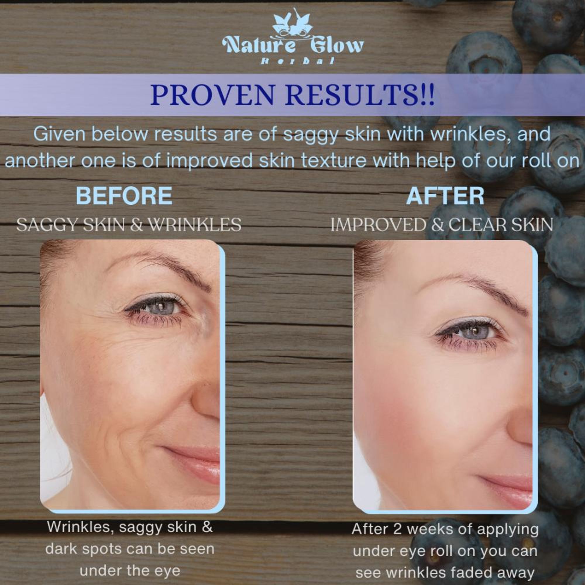 Nature Glow Herbal Under Eye Blueberry Roll On - Distacart