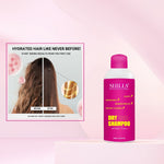 Thumbnail for shills professional dry shampoo