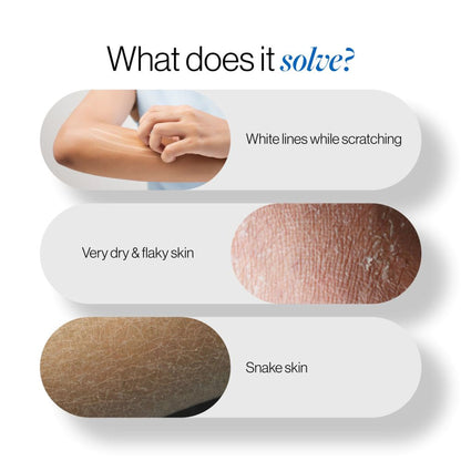 BeBodywise 20% Urea Body Lotion - Advanced Formulation - Dista