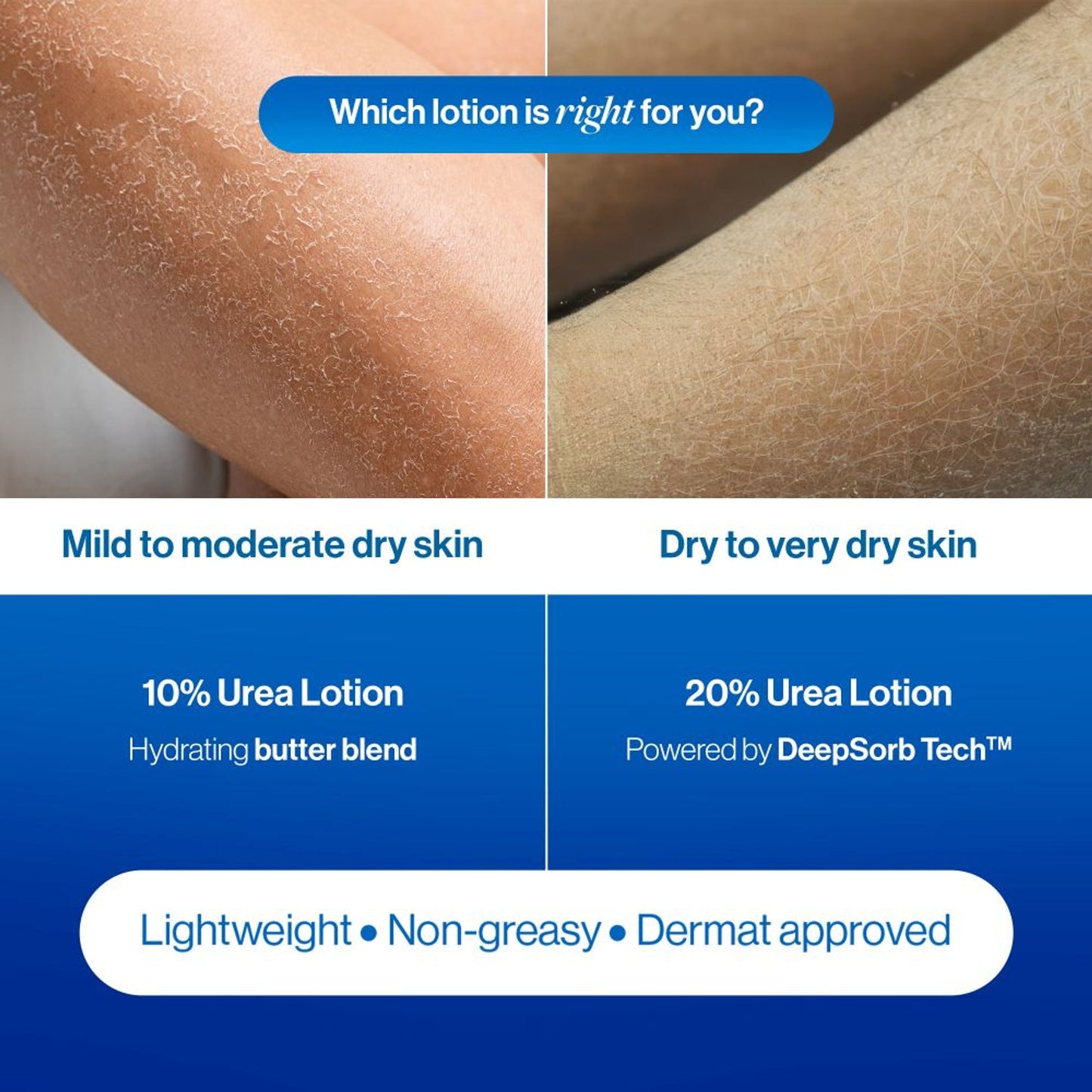 BeBodywise 20% Urea Body Lotion - Advanced Formulation - Dista