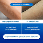 Thumbnail for BeBodywise 20% Urea Body Lotion - Advanced Formulation