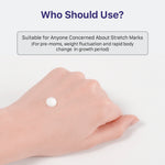 Thumbnail for Illiyoon Stretch Mark Cream - Distacart